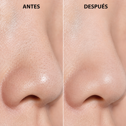 Depurador Facial Ultrasónico