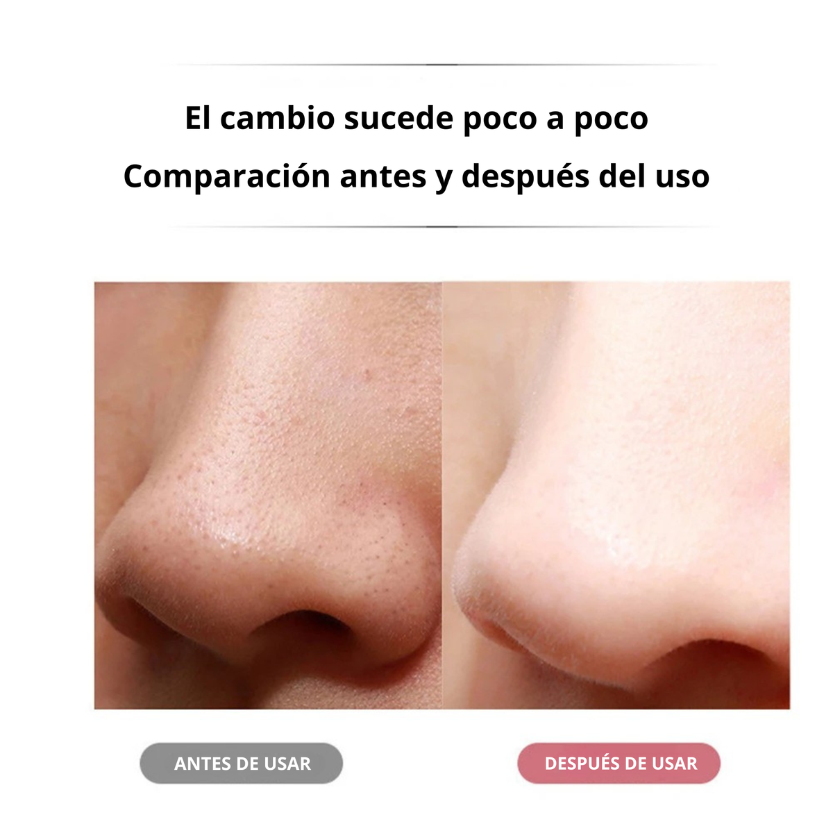 Depurador Facial Ultrasónico
